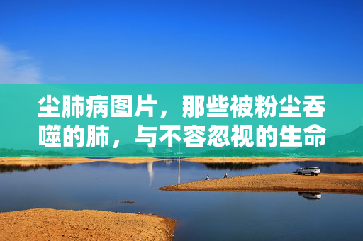 尘肺病图片,那些被粉尘吞噬的肺,与不容忽视的生命警示,粉尘吞噬的肺,不容忽视的生命警示 尘肺病图片,那些被粉尘吞噬的肺,与不容忽视的生命警示,粉尘吞噬的肺,不容忽视的生命警示