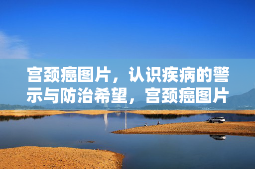 宫颈癌图片,认识疾病的警示与防治希望,宫颈癌图片,警示与防治的希望 宫颈癌图片,认识疾病的警示与防治希望,宫颈癌图片,警示与防治的希望
