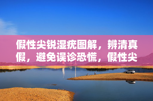 假性尖锐湿疣图解,辨清真假,避免误诊恐慌,假性尖锐湿疣图解,辨清真假,避免误诊恐慌 假性尖锐湿疣图解,辨清真假,避免误诊恐慌,假性尖锐湿疣图解,辨清真假,避免误诊恐慌