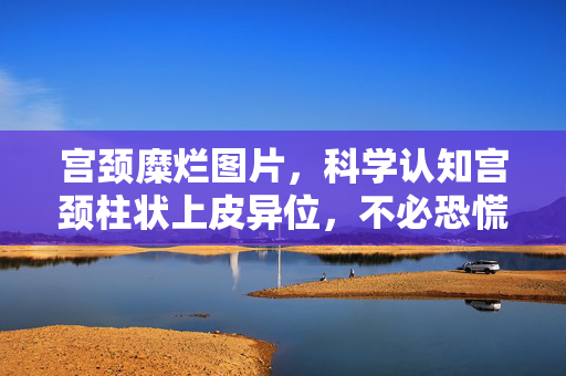宫颈糜烂图片,科学认知宫颈柱状上皮异位,不必恐慌的生理现象,科学认知宫颈柱状上皮异位,不必恐慌的生理现象 宫颈糜烂图片,科学认知宫颈柱状上皮异位,不必恐慌的生理现象,科学认知宫颈柱状上皮异位,不必恐慌的生理现象