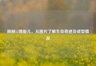 探秘12周胎儿，从图片了解生命奇迹及成型情况